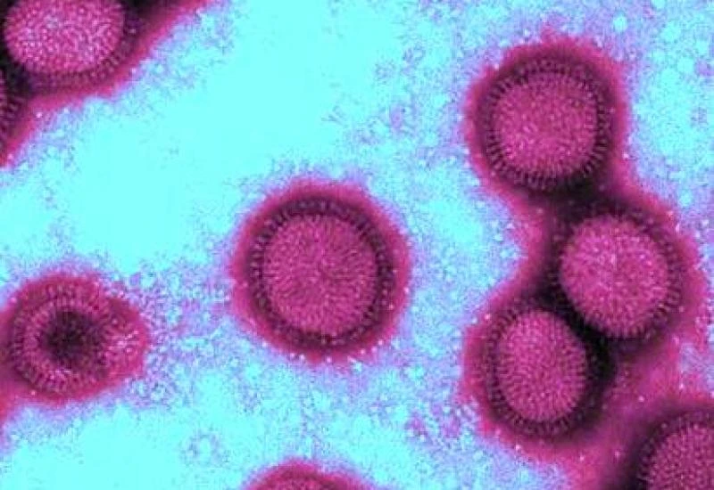 Свинячий грип: що варто знати про H1N1 сьогодні